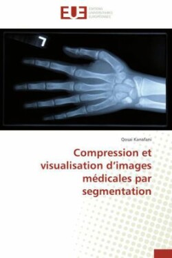 Compression Et Visualisation D Images M�dicales Par Segmentation