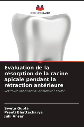 Évaluation de la résorption de la racine apicale pendant la rétraction antérieure