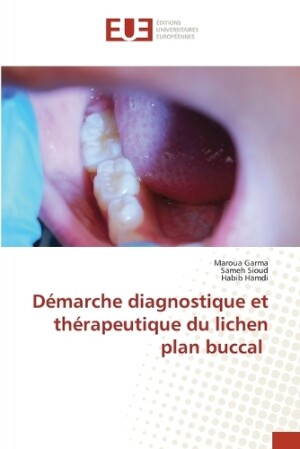 Démarche diagnostique et thérapeutique du lichen plan buccal