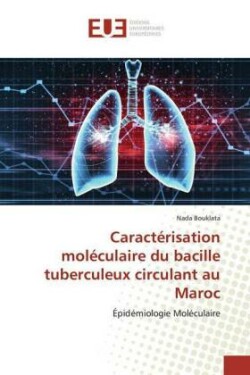 Caractérisation moléculaire du bacille tuberculeux circulant au Maroc