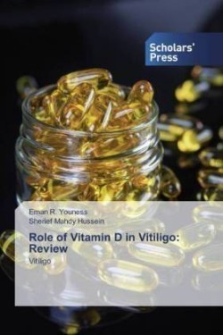 Role of Vitamin D in Vitiligo