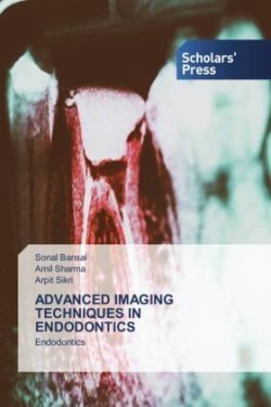 Advanced Imaging Techniques in Endodontics