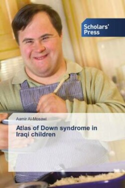 Atlas of Down syndrome in Iraqi children