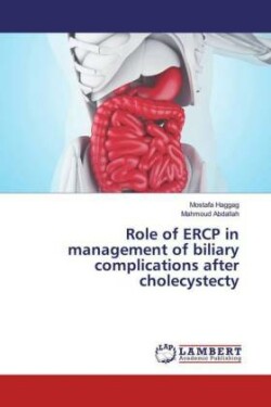 Role of ERCP in management of biliary complications after cholecystecty