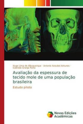 Avaliação da espessura de tecido mole de uma população brasileira