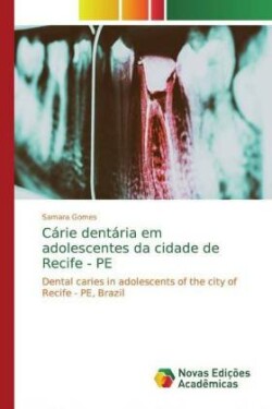 Cárie dentária em adolescentes da cidade de Recife - PE