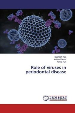 Role of viruses in periodontal disease