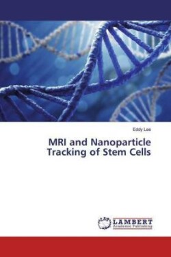 MRI and Nanoparticle Tracking of Stem Cells