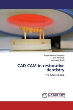 CAD CAM in restorative dentistry