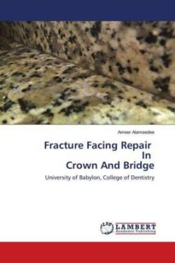 Fracture Facing Repair In Crown And Bridge
