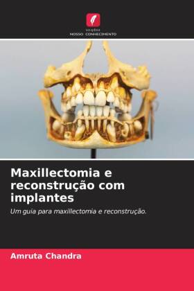 Maxillectomia e reconstrução com implantes