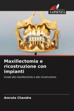 Maxillectomia e ricostruzione con impianti