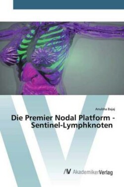 Die Premier Nodal Platform - Sentinel-Lymphknoten