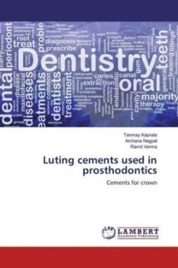 Luting cements used in prosthodontics