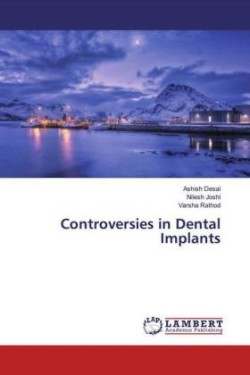 Controversies in Dental Implants