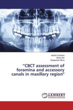 "CBCT assessment of foramina and accessory canals in maxillary region"