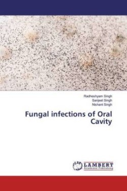 Fungal infections of Oral Cavity