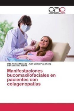 Manifestaciones bucomaxilofaciales en pacientes con colagenopatías