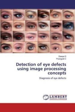 Detection of eye defects using image processing concepts