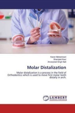 Molar Distalization