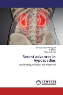 Recent advances in hypospadias