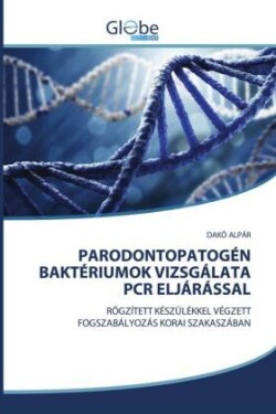 Parodontopatogén Baktériumok Vizsgálata PCR Eljárással
