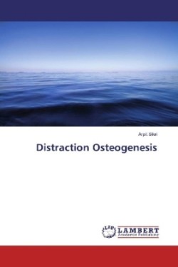 Distraction Osteogenesis