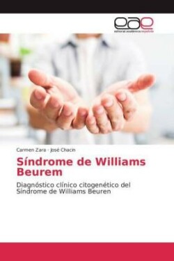 Síndrome de Williams Beurem