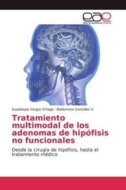 Tratamiento multimodal de los adenomas de hipófisis no funcionales