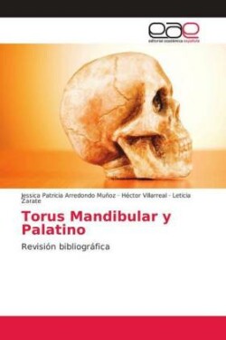 Torus Mandibular y Palatino