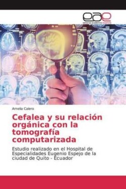 Cefalea y su relación orgánica con la tomografía computarizada