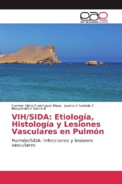 VIH/SIDA: Etiología, Histología y Lesiones Vasculares en Pulmón