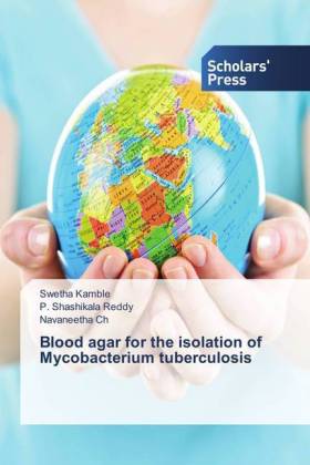 Blood agar for the isolation of Mycobacterium tuberculosis