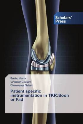 Patient specific instrumentation in TKR:Boon or Fad