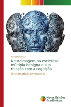 Neuroimagem na esclerose múltipla benigna e sua relação com a cognição