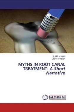 Myths in Root Canal Treatment - A Short Narrative