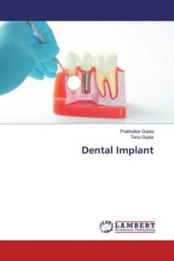 Dental Implant