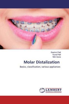 Molar Distalization