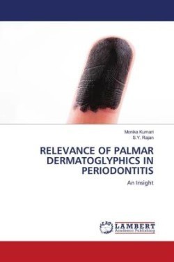 RELEVANCE OF PALMAR DERMATOGLYPHICS IN PERIODONTITIS