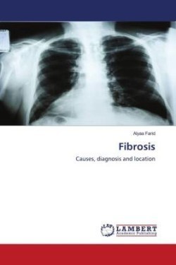 Fibrosis