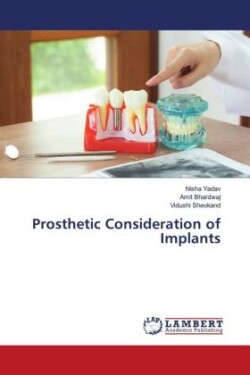 Prosthetic Consideration of Implants