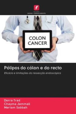 Pólipos do cólon e do recto