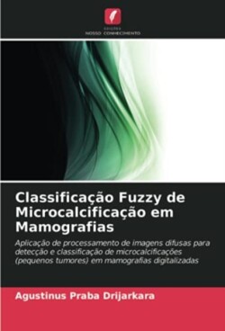 Classificação Fuzzy de Microcalcificação em Mamografias