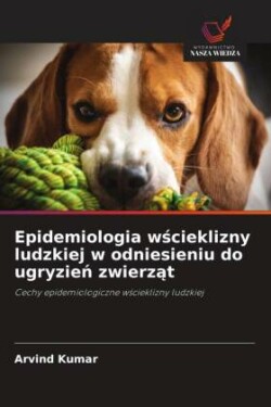 Epidemiologia wścieklizny ludzkiej w odniesieniu do ugryzień zwierząt