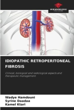 Idiopathic Retroperitoneal Fibrosis