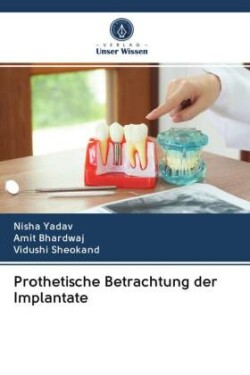 Prothetische Betrachtung der Implantate