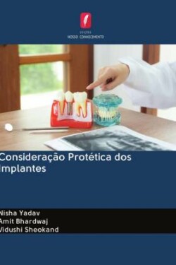 Consideração Protética dos Implantes