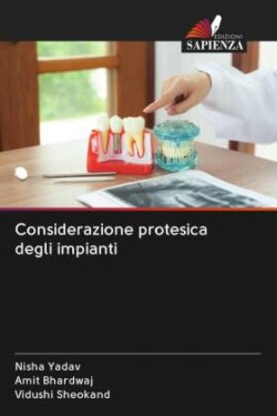 Considerazione protesica degli impianti