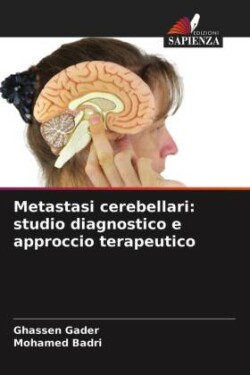 Metastasi cerebellari