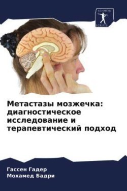 Метастазы мозжечка
